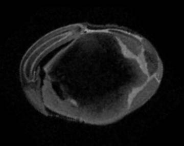 Pictured is an MRI image of a soybean as it is being rehydrated.The water inside of the bean shows up as white in the MRI.