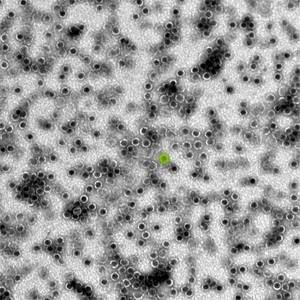 A grayscale electron micrograph shows dozens of dark orbs dotting a light gray background. One orb is highlighted in green to emphasize the size of an individual microcompartment. 