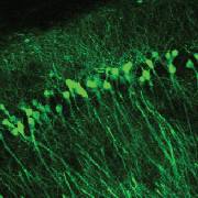A group of neurons forming a brain circuit. 