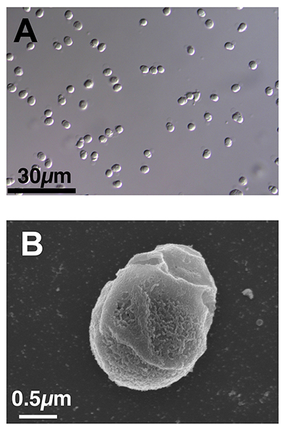 The sperm of the mormyrid weakly electric fish Paramormyrops kingsleyae is the only known vertebrate species that lacks a flagellum. Panel A shows a light microscope image of a sperm sample: the sperm are completely immotile. Panel B shows an scanning electron microscope image of a single Paramormyrops kinglsyeae sperm cell.