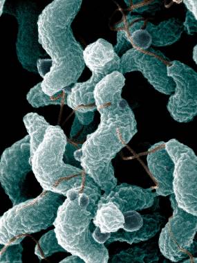 An electron microscope image shows a close-up of corkscrew-shaped Campylobacter jejuni bacteria. Some are connected by thin filaments.