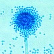 Michigan State University researchers helped show how fungus like Aspergillus sydowii, shown here, can restructure their cell walls to survive in extremely salty conditions. 