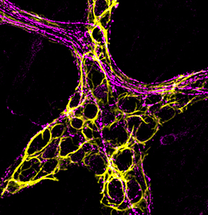 A micrograph shows a network of looping yellow lines intertwined with gently curved magenta traces. These show the position of glial cells (yellow) and neurons (magenta) in a mouse colon sample.
