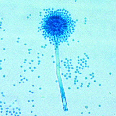 Michigan State University researchers helped show how fungus like Aspergillus sydowii, shown here, can restructure their cell walls to survive in extremely salty conditions. 