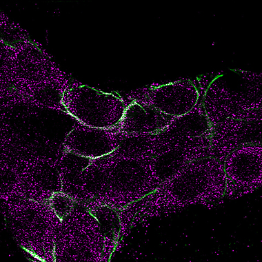 Glial cells are visible in looping green traces against a black background. Purple loops coincide with some of the loops, showing where a nerve-sensitizing compound is being released.