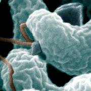 A colorized electron microscope image shows a close-up of Campylobacter jejuni bacteria, many of which carry antibiotic resistant genes, as shown by Michigan State University researchers.