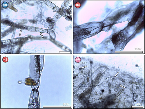 Four panels of microscopic analysis. The images show long, tube-like moss cells that have been colonized by smaller, filament-like fungal structures. White arrows are superimposed on the images, pointing to specific interactions.