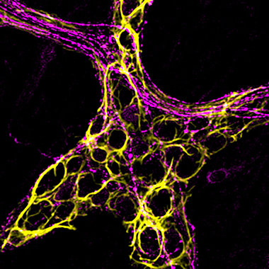 A micrograph shows a network of looping yellow lines intertwined with gently curved magenta traces. These show the position of glial cells (yellow) and neurons (magenta) in a mouse colon sample.