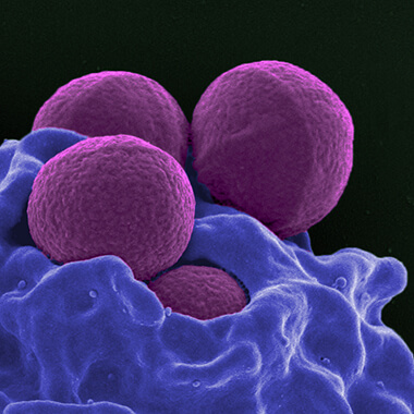 Four round MRSA cells are shown in purple in a colorized electron micrograph. 