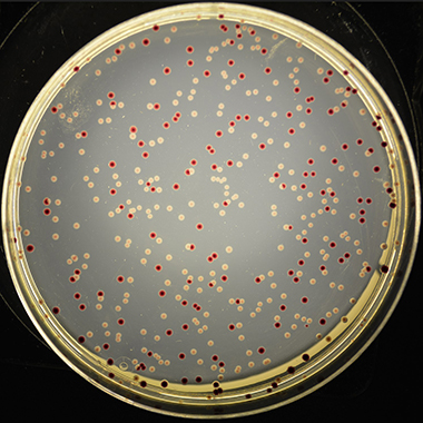 Microbial communities appear as little yellow and red dots, speckling the interior of a Petri dish.