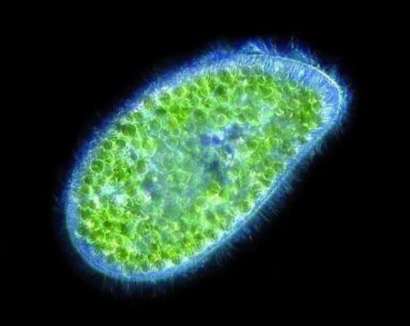 An image from under a microscope of a cell with microalgae engulfed within