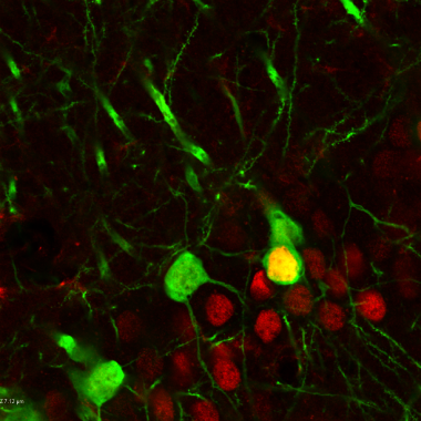Neurons are dyed green and red under a microscope