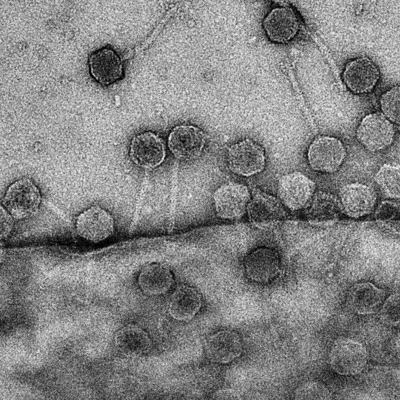 bacteriophages attacking a cell