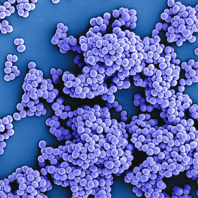 clusters of tiny blue spheres on a blue background