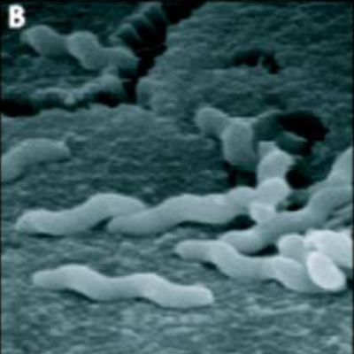 black and white image of worm-like organism on a bumpy surface
