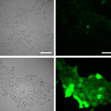 A close-up of several cancer cells, gray, green, and black.