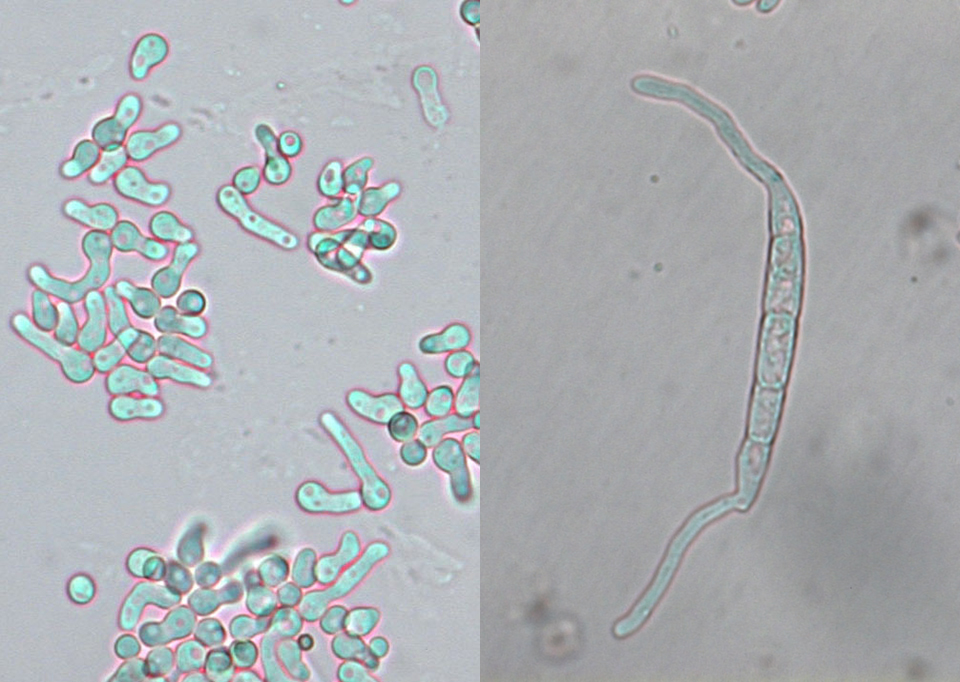 Images of Aspergillus and Fusarium germinating spores