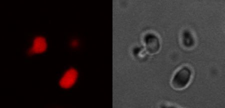 Liquid droplets of smal globular RNA with positively charged trypsin