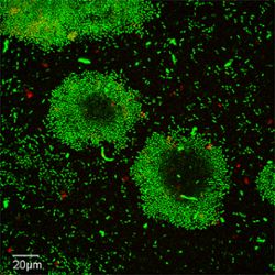 Image of vibrio cholerea