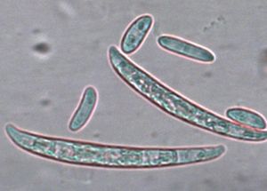 Two kinds of spores produced by Fusarium oxysporum, a common pathogen of vegetables. 