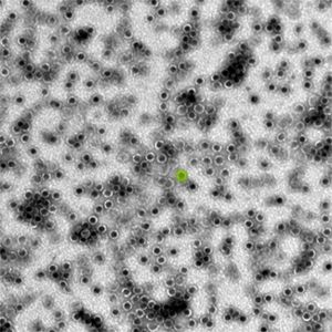An image of orbs, where each orb â€” one has been highlighted in lime green â€” is a bacterial microcompartment, about 40 nanometers in diameter. 