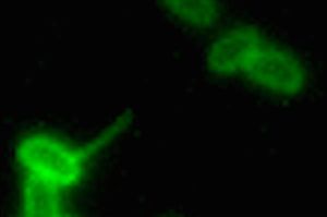A green-and-black microscope image shows a bacterial cell in the lower left-hand corner of the image extending a long, thin arm-like appendage to grab a clump of DNA toward the opposite corner of the image.